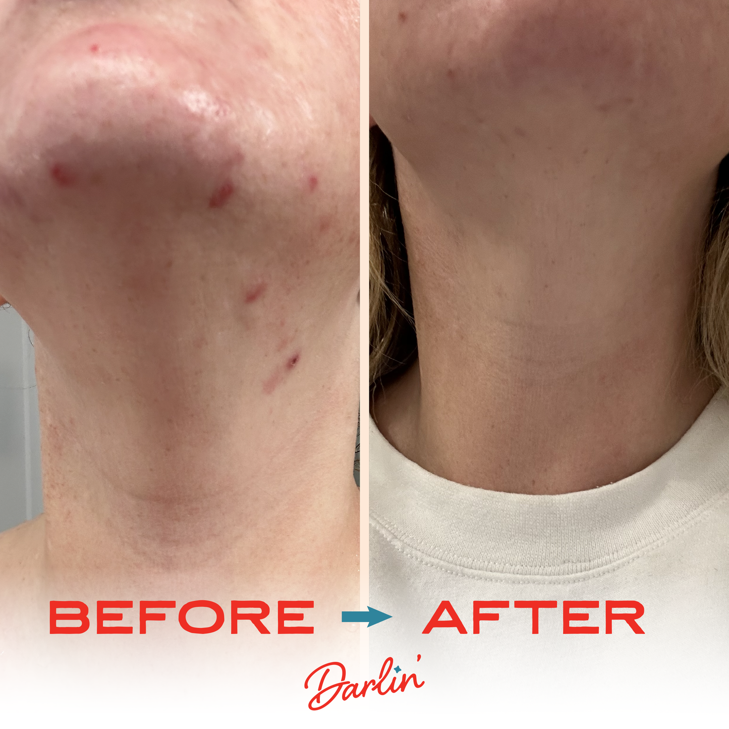 Darlin' Skincare - Tallow Face Balm